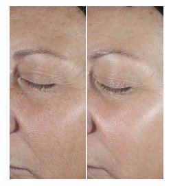 Smart Clinical Repair Serum - Anti-Wrinkle Correcting Serum Smart Clinical Repair Serum - Anti-Wrinkle Correcting Serum